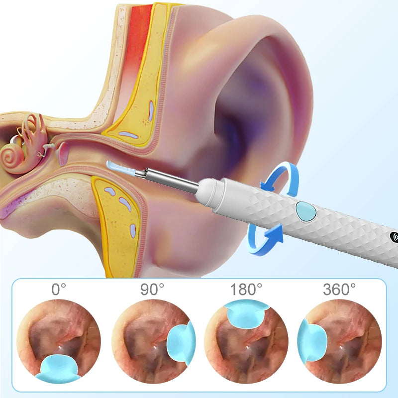 GlowWave Smart EarCam - vezeték nélküli fültisztító kamera